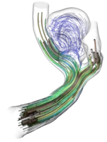 Streamlines in (untreated) aneurysm and adjacent vessels.